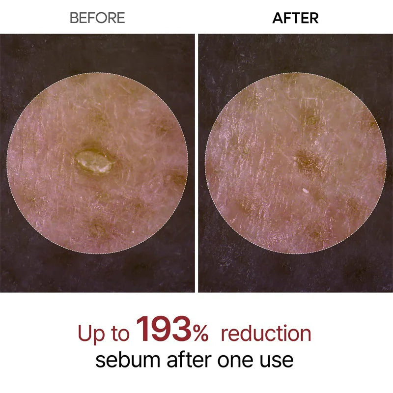 Peel Shot Glow Rice Peeling Ampoule Exfoliator Serum