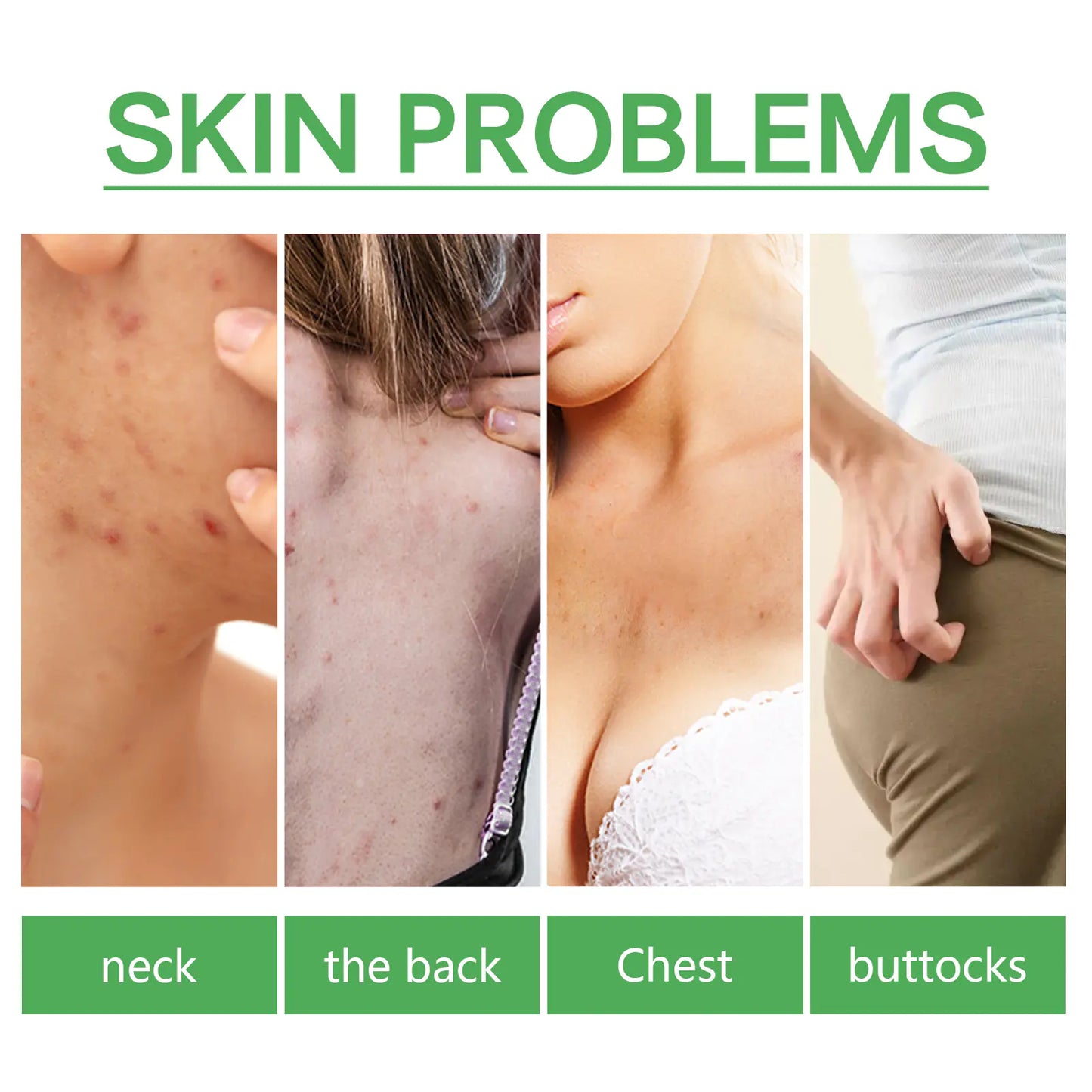 Jaysuing Acne Spot Lightening Serum för hudvård