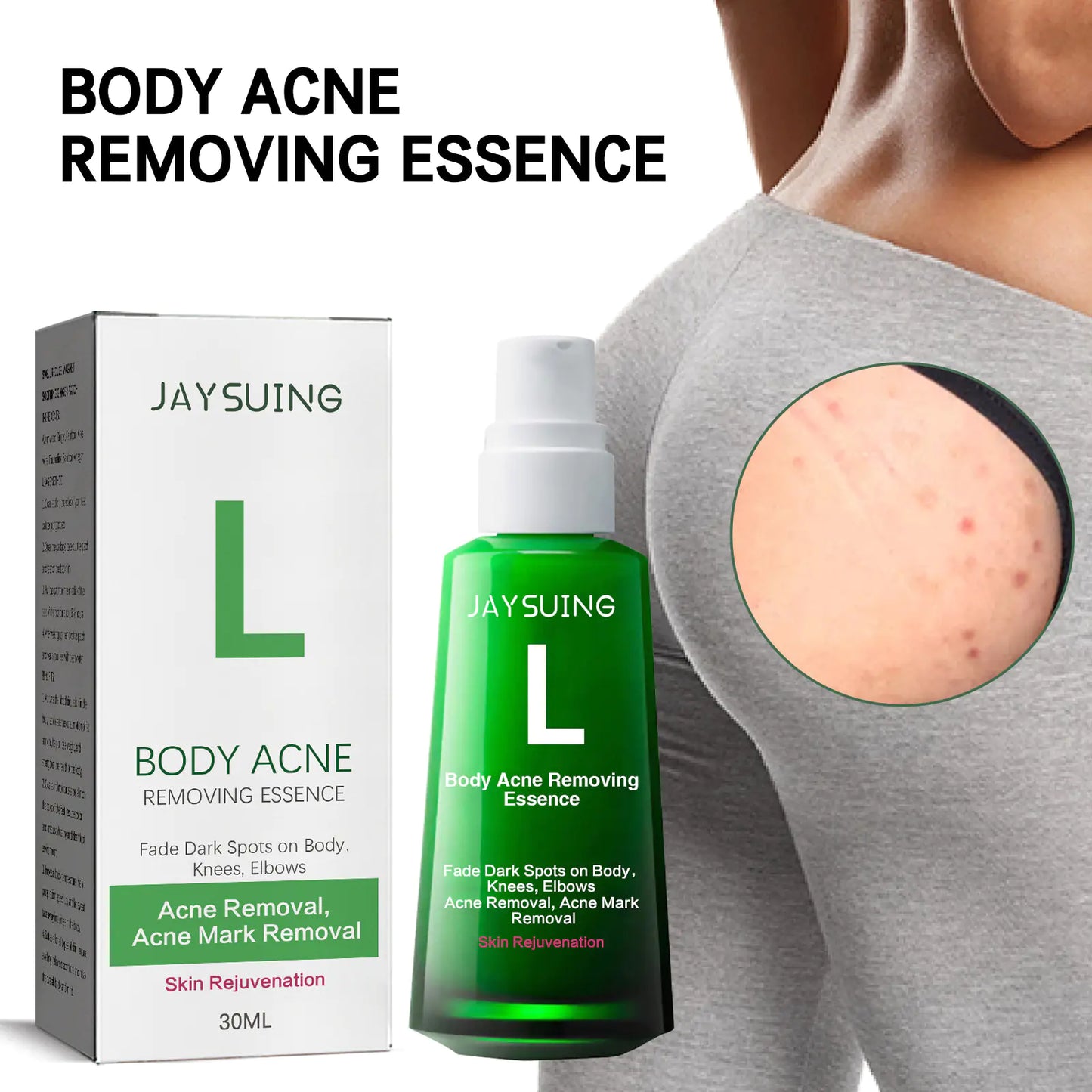 Jaysuing Acne Spot Lightening Serum för hudvård