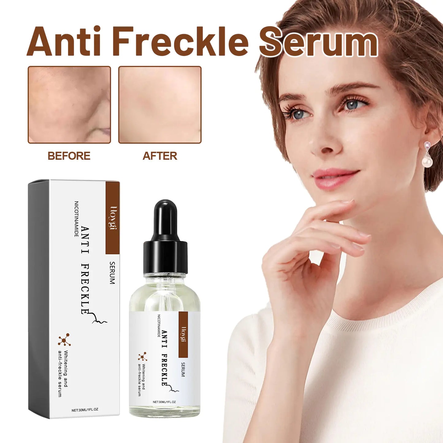 Hoygi ™ Niacinamid-Anti-Fried-Serum zur Klärung und Hydratation