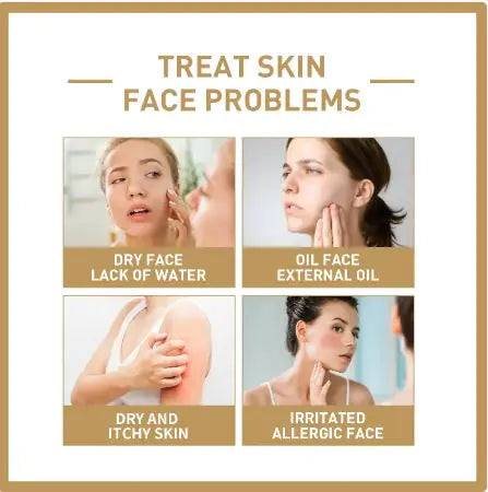 Beckers Amsterdam ™ - feuchtigkeitsspendende Reisgesichtstoner