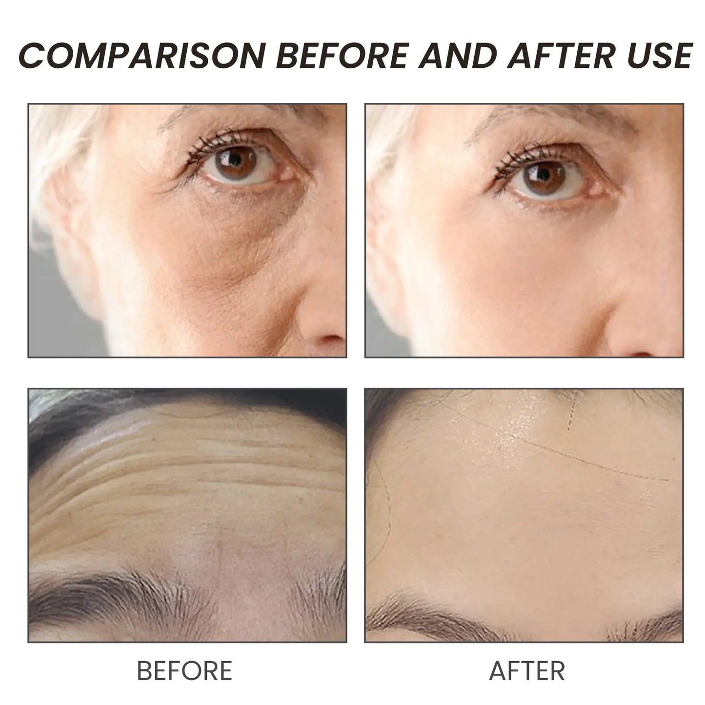 OUHOE Anti-rynka Serum för Fastare Hud