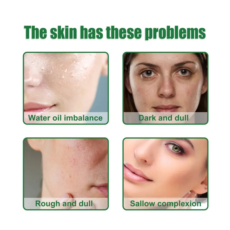 Ouhu Anti-Acne-Gesichtserum für Ölkontrolle und Poren