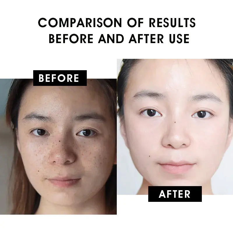 Carvenchy™ - Vitamin C Serum Creamy Firming Essence
