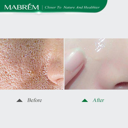 MABRÉM™ - Pomegranate Serum for Enlarged Pores