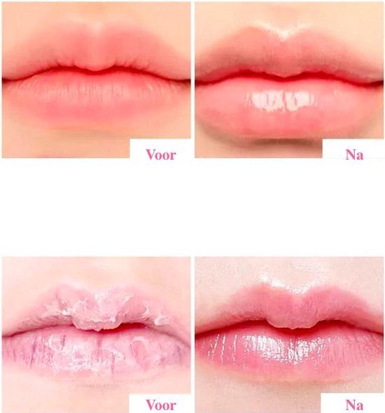 Derol™ - Firming and Hydrating Lip Care Serum