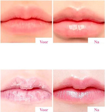 Derol™ - Firming and Hydrating Lip Care Serum