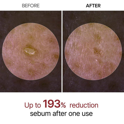 Peel Shot Glow Rice Peeling Ampoule Exfoliator Serum
