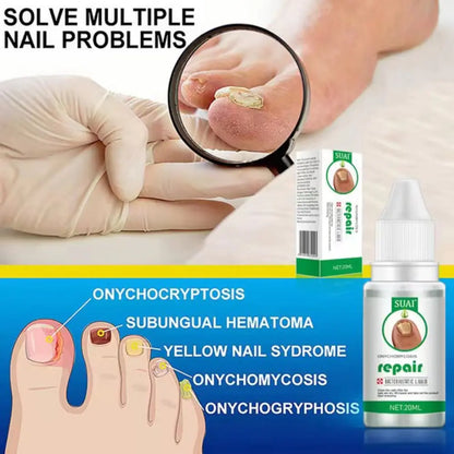 Nail Fungus Treatment Serum for Hand and Foot Care