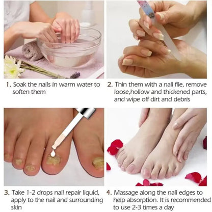 Nail Fungus Treatment Serum for Hand and Foot Care