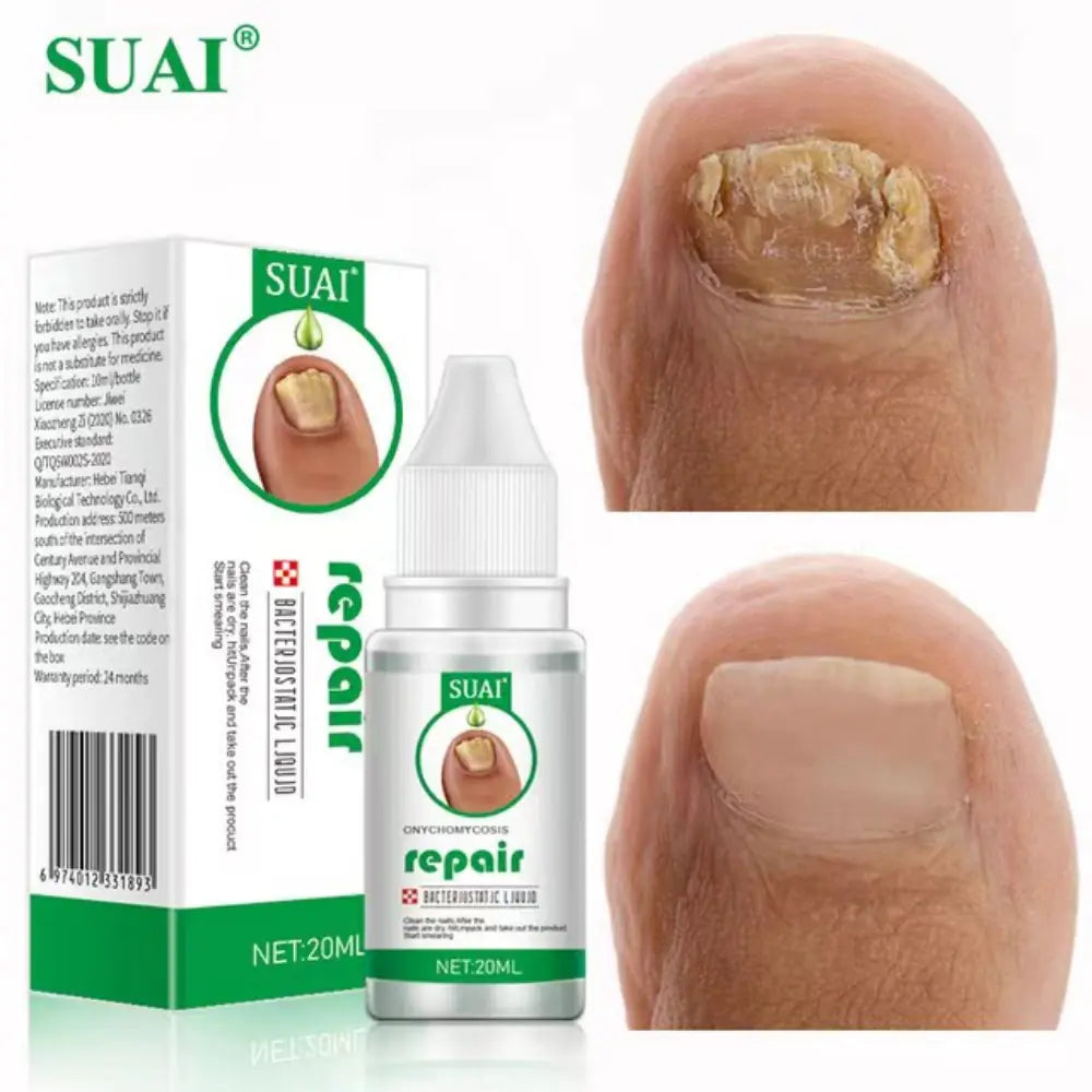 Nail Fungus Treatment Serum for Hand and Foot Care