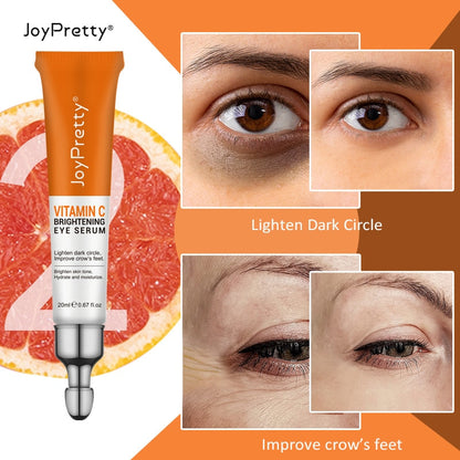 Vitamin C  Under Eye Cream for Dark Circles and Eye Bags