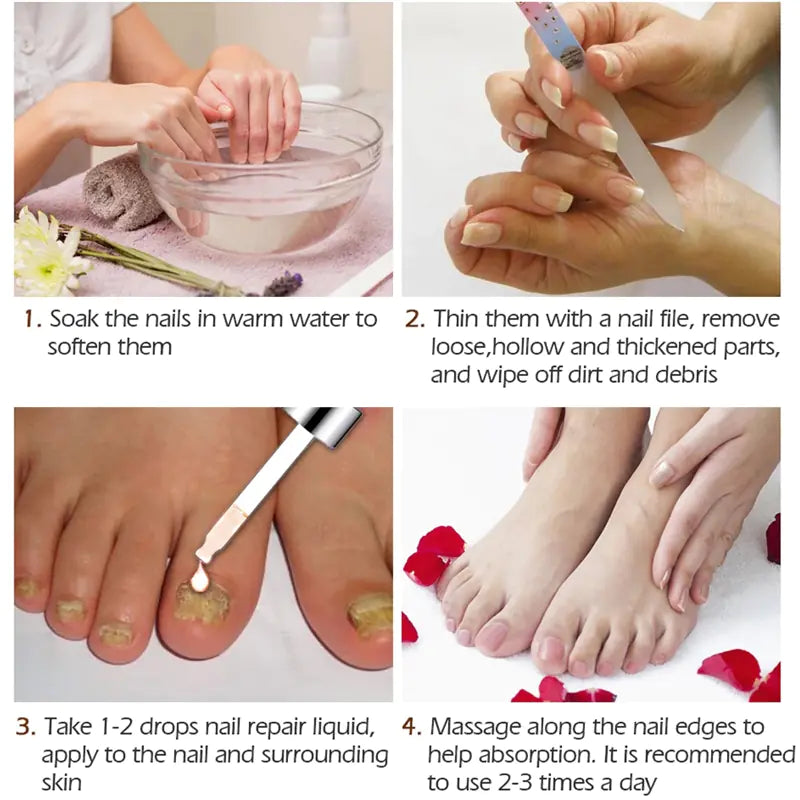 Nail Serum for Foot Care and Fungus Removal Gel 
