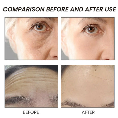 OUHOE Anti-rynka Serum för Fastare Hud