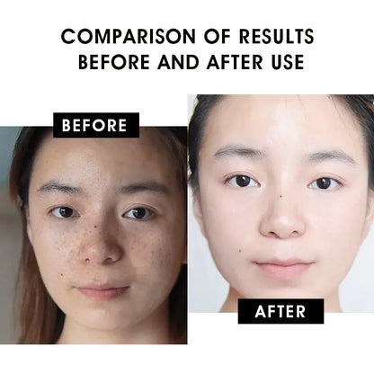 Carvenchy™ - Vitamin C Serum Creamy Firming Essence
